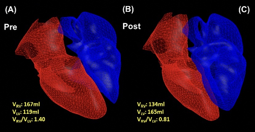 Cardiac Assestment