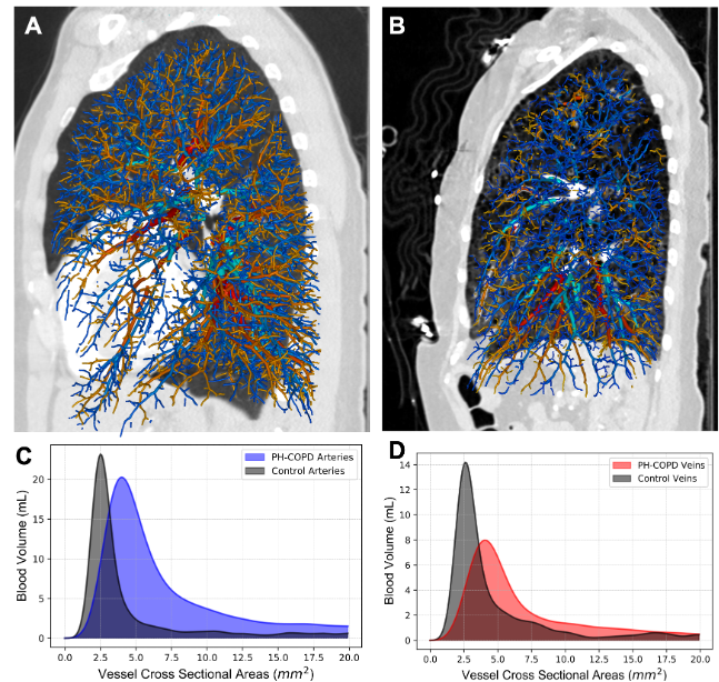 Vascular Injury Quantification